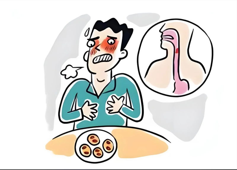 食管早癌筛查：守护食管健康的关键防线